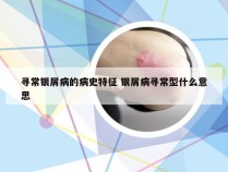 寻常银屑病的病史特征 银屑病寻常型什么意思