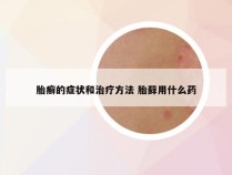胎癣的症状和治疗方法 胎藓用什么药