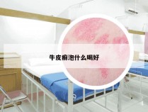 牛皮癣泡什么喝好