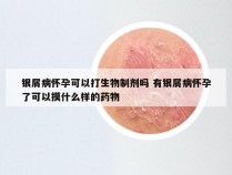 银屑病怀孕可以打生物制剂吗 有银屑病怀孕了可以摸什么样的药物