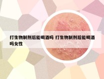 打生物制剂后能喝酒吗 打生物制剂后能喝酒吗女性