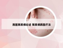 西医银屑病论述 银屑病西医疗法
