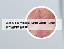小孩身上气了不同大小的白点图片 小孩身上有凸起的白色斑块