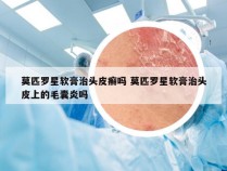 莫匹罗星软膏治头皮癣吗 莫匹罗星软膏治头皮上的毛囊炎吗