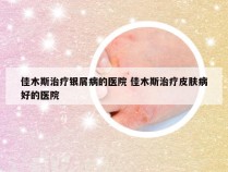 佳木斯治疗银屑病的医院 佳木斯治疗皮肤病好的医院