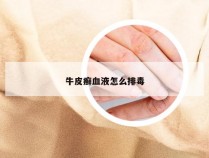 牛皮癣血液怎么排毒