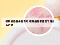 银屑病感冒会复发吗 银屑病患者感冒了用什么药好