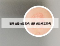 银屑病能吃豆浆吗 银屑病能喝豆浆吗