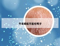 牛皮癣能不能吃鸭子
