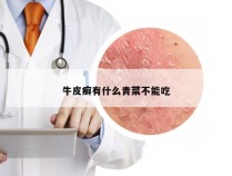 牛皮癣有什么青菜不能吃