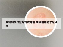 生物制剂打过起鸡皮疙瘩 生物制剂打了起红疹