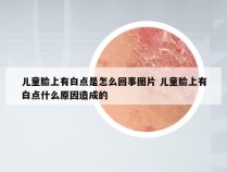 儿童脸上有白点是怎么回事图片 儿童脸上有白点什么原因造成的