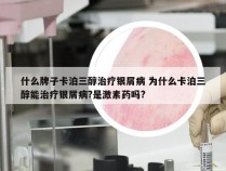 什么牌子卡泊三醇治疗银屑病 为什么卡泊三醇能治疗银屑病?是激素药吗?