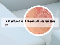 大风子治牛皮癣 大风子的功效与作用用量归经