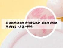 副银屑病跟银屑病有什么区别 副银屑病和银屑病的治疗方法一样吗