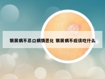 银屑病不忌口病情恶化 银屑病不应该吃什么