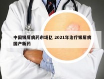 中国银屑病药市场亿 2021年治疗银屑病国产新药