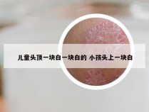 儿童头顶一块白一块白的 小孩头上一块白