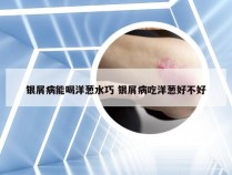 银屑病能喝洋葱水巧 银屑病吃洋葱好不好