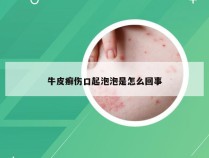 牛皮癣伤口起泡泡是怎么回事