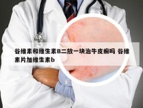 谷维素和维生素B二放一块治牛皮癣吗 谷维素片加维生素b