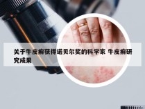 关于牛皮癣获得诺贝尔奖的科学家 牛皮癣研究成果