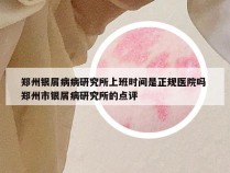 郑州银屑病病研究所上班时间是正规医院吗 郑州市银屑病研究所的点评