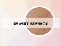 银屑病喝苦丁 银屑病喝苦丁茶
