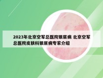 2023年北京空军总医院银屑病 北京空军总医院皮肤科银屑病专家介绍
