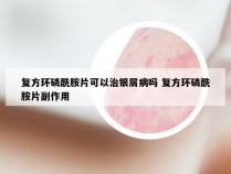 复方环磷酰胺片可以治银屑病吗 复方环磷酰胺片副作用