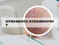 维芳银屑病医院好吗 维芳银屑病医院好吗知乎