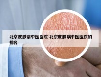 北京皮肤病中医医院 北京皮肤病中医医院的排名