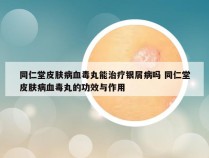 同仁堂皮肤病血毒丸能治疗银屑病吗 同仁堂皮肤病血毒丸的功效与作用