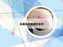 白癜风早期图片参考