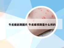 牛皮廨前期图片 牛皮廨初期是什么样的