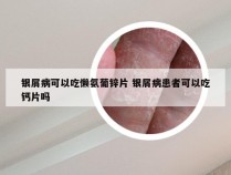 银屑病可以吃懒氨葡锌片 银屑病患者可以吃钙片吗