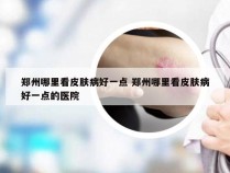 郑州哪里看皮肤病好一点 郑州哪里看皮肤病好一点的医院