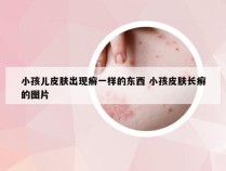 小孩儿皮肤出现癣一样的东西 小孩皮肤长癣的图片