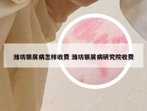 潍坊银屑病怎样收费 潍坊银屑病研究院收费