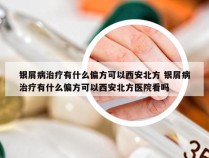 银屑病治疗有什么偏方可以西安北方 银屑病治疗有什么偏方可以西安北方医院看吗