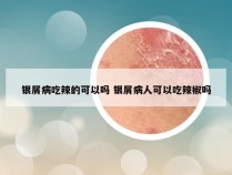 银屑病吃辣的可以吗 银屑病人可以吃辣椒吗