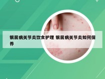 银屑病关节炎饮食护理 银屑病关节炎如何保养