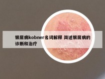 银屑病kobner名词解释 简述银屑病的诊断和治疗