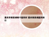 重庆市银屑病哪个医院好 重庆银屑病医院排行