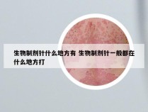 生物制剂针什么地方有 生物制剂针一般都在什么地方打