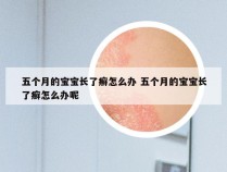 五个月的宝宝长了癣怎么办 五个月的宝宝长了癣怎么办呢