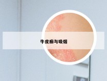 牛皮癣与吸烟