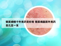 银屑病哪个外用药膏好用 银屑病最新外用药膏几百一支