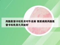丙酸氟替卡松乳膏对牛皮癣 银屑病用丙酸氟替卡松乳膏几天能好