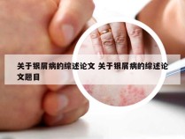 关于银屑病的综述论文 关于银屑病的综述论文题目
